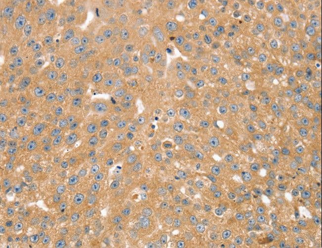 SNX2 Antibody