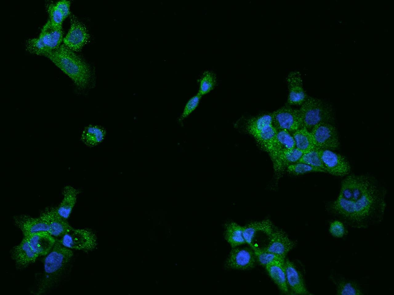 NAG20 / UBAP1 Antibody