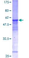 Human THOC6 Protein (Recombinant GST)