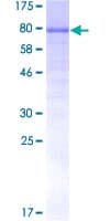 Human CAMKK1 Protein (Recombinant GST)
