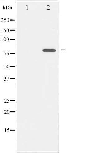 MAPT / Tau Antibody (phospho-Ser422)
