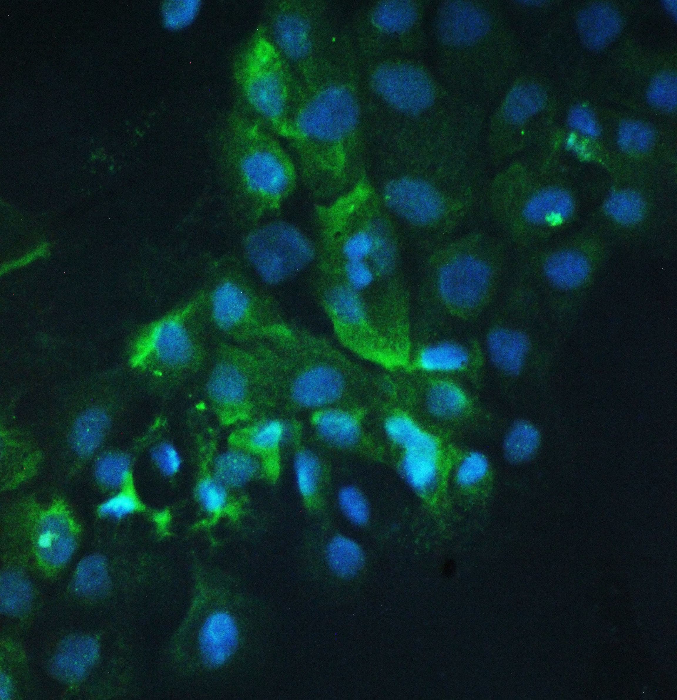 CTTN / Cortactin Antibody