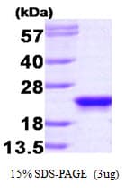 Human PEBP1 / RKIP Protein (Recombinant)
