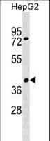 Polyclonal Rabbit anti-Human SNX32 Antibody (aa1-30, WB)