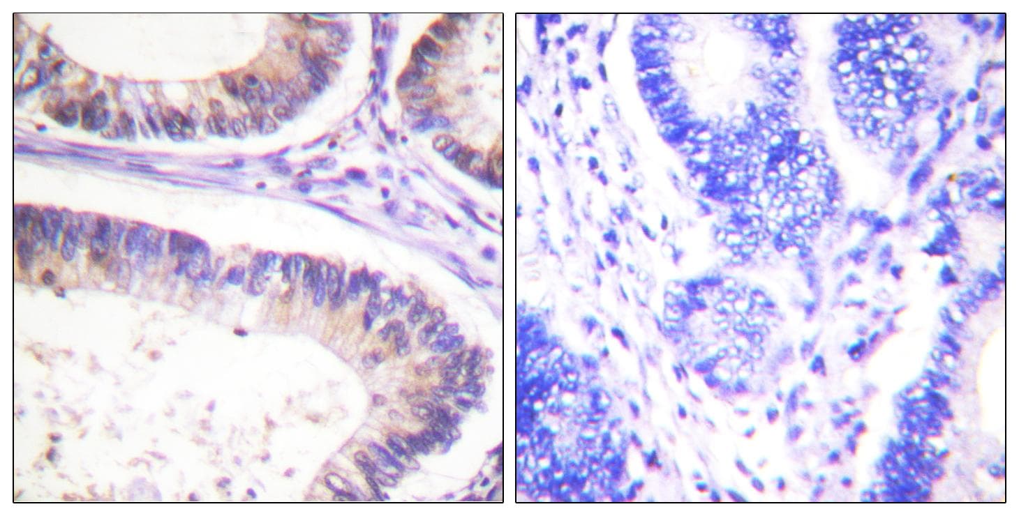 c-CBL Antibody (phospho-Tyr674)
