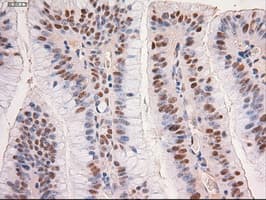 MYC / c-Myc Antibody (clone OTI5G3)