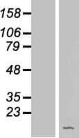 C1orf189 Protein (Over-Expression Lysate Myc-DDK (Flag))