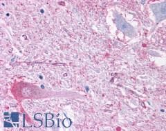 PathPlus™ GRM2 / MGLUR2 Antibody (N-Terminus)