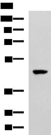 SNIP1 Antibody