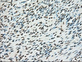 Monoclonal Mouse anti-Human TYRO3 Antibody (clone OTI2G2, IHC, WB)
