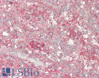 IHC-plus™ SLC6A6 / Taurine Transporter Antibody (C-Terminus)