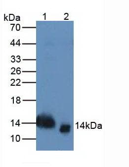 TFF2 / SP Antibody (aa27-129)