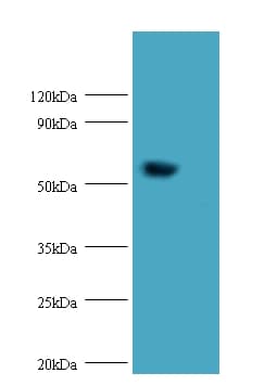 HARS2 Antibody (Biotin)