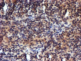 Monoclonal Mouse anti-Human RFXANK Antibody (clone OTI2B6, IHC, IF, WB)