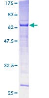 Human SPO11 Protein (Recombinant GST)