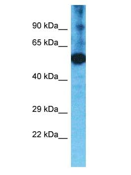 TMPRSS11F Antibody (aa279-328)