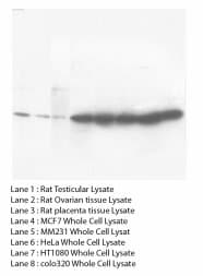 CCND2 / Cyclin D2 Antibody (C-Terminus, Sepharose)