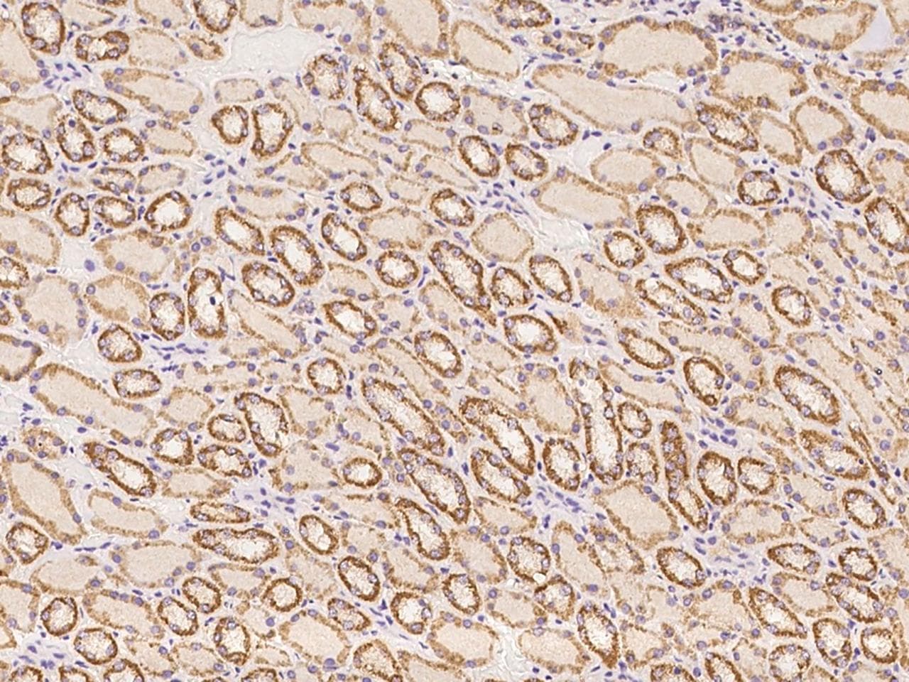 Polyclonal Rabbit anti-Human RPRML Antibody (IHC)