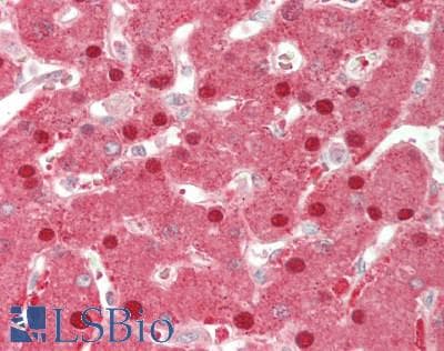 Polyclonal Rabbit anti-Human GPT / Alanine Transaminase Antibody (aa147-263, IHC, WB)