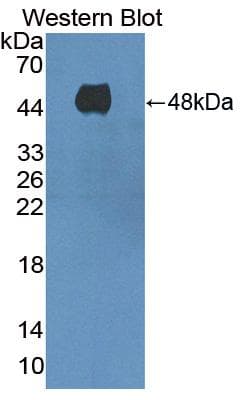 ADCY8 / Adenylate Cyclase 8 Antibody (aa234-371, FITC)