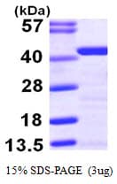 Human TPM2 Protein (Recombinant His)