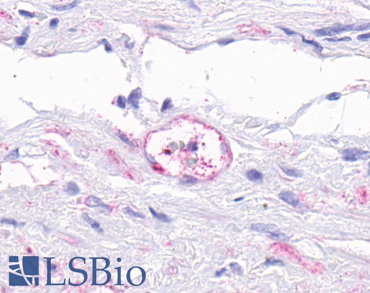 PathPlus™ ADGRA2 / GPR124 Antibody (N-Terminus)
