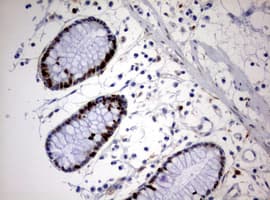 MKI67 / Ki67 Antibody (aa1160-1493, clone OTI5E6)