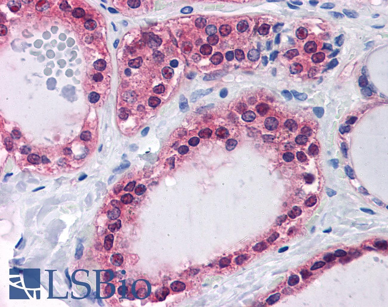 IHC-plus™ SDSL / Serine Dehydratase-Like Antibody (clone M2)