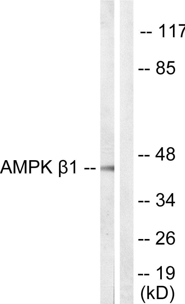 Polyclonal Rabbit anti-Human PRKAB1 / AMPK Beta 1 Antibody (p181, IHC, WB)