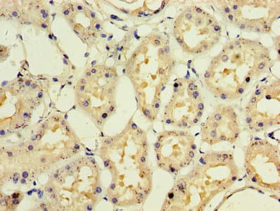 IFNA10 / Interferon Alpha 10 Antibody
