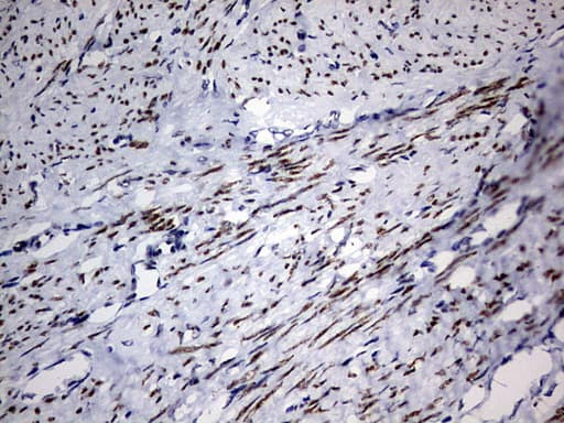 H2AFY2 Antibody (aa2-261, clone OTI1E1, Carrier-free)