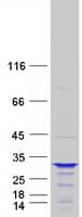 Human CCDC28B Protein (Recombinant Myc-DDK (Flag))