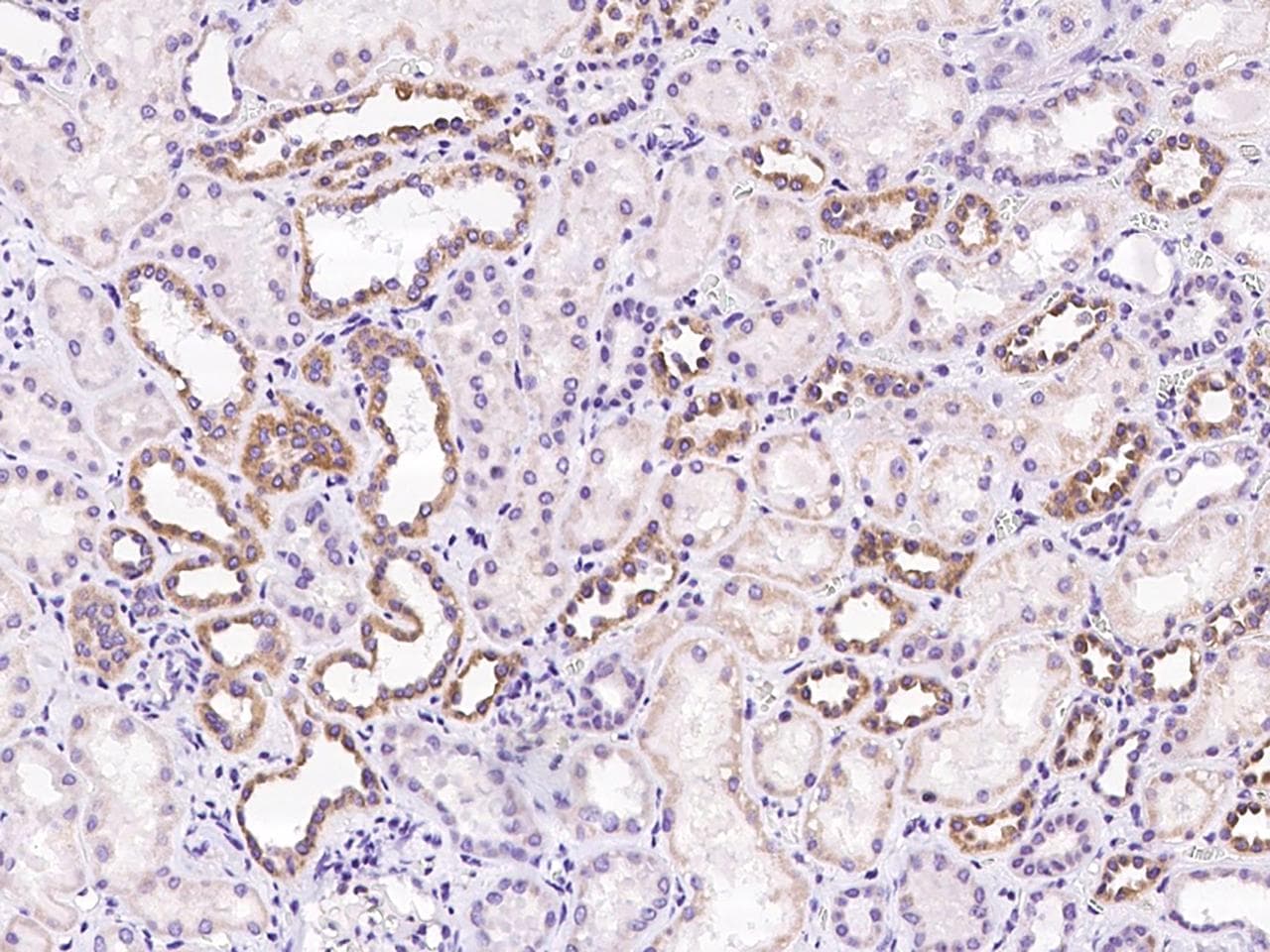 APOBEC3D Antibody