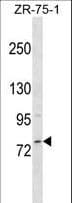 MICALCL Antibody (aa135-163)