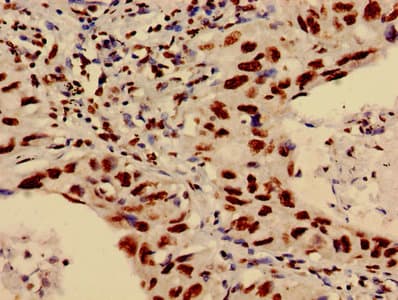 HIST1H3A Antibody