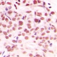 MYC / c-Myc Antibody (phospho-Ser62)