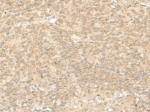 Polyclonal Rabbit anti-Human ENSA Antibody (IHC)