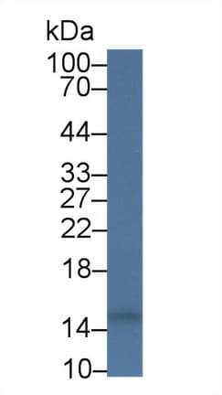 CST3 / Cystatin C Antibody (aa32-148)