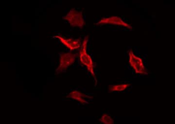 Polyclonal Rabbit anti-Human HTR3D / 5HT3D Receptor Antibody (IF, WB)