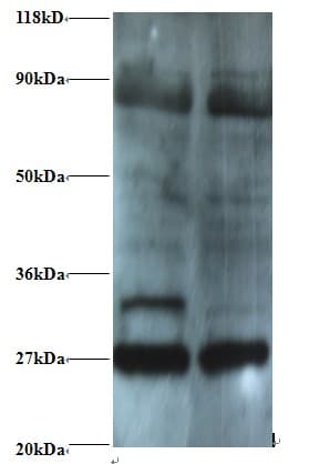 PSMB2 Antibody
