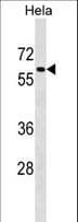 Polyclonal Rabbit anti-Human PD2 / PAF1 Antibody (aa439-467, WB)