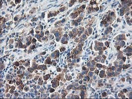RPN1 / Ribophorin I Antibody (clone OTI3E1, Carrier-free)
