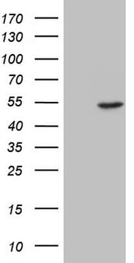 ESRRA / ERR Alpha Antibody (aa206-417, clone OTI1C6)