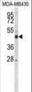 IHC-plus™ Polyclonal Rabbit anti-Human CYP21A2 Antibody (aa216-246, IHC, IF, WB)