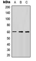 ALK3 / BMPR1A Antibody (N-Terminus)