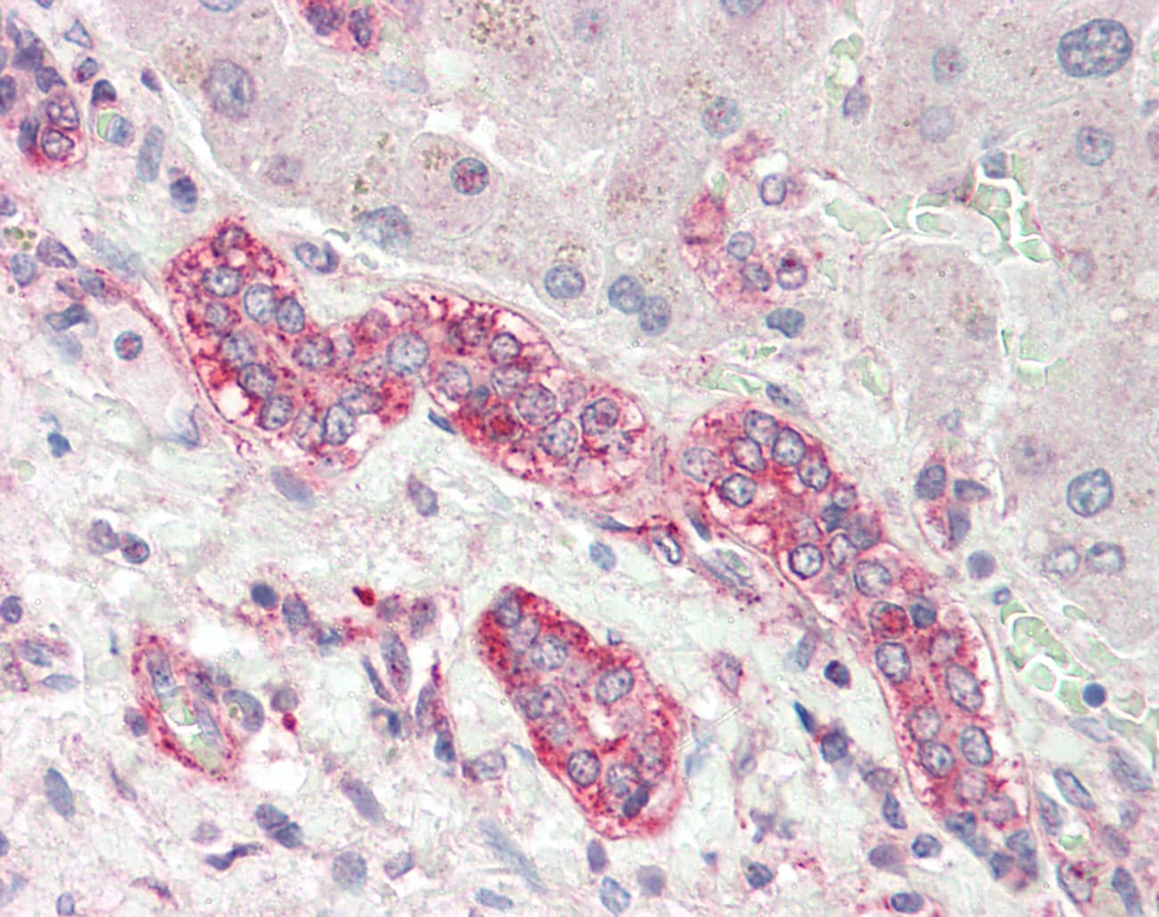 Polyclonal Rabbit anti-Human MRPS11 Antibody (aa113-162, IHC, WB)