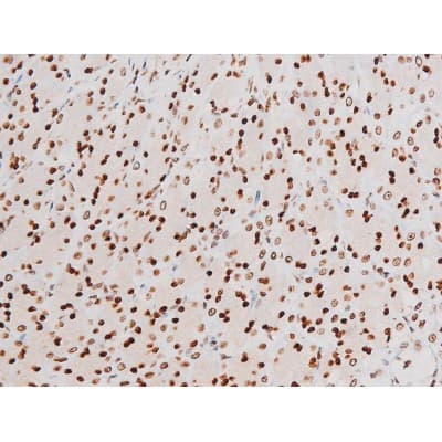 Polyclonal Rabbit anti-Human RELA / NFKB p65 Antibody (phospho-Thr435, IHC, IF, WB)