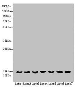 Polyclonal Rabbit anti-Human MRPS16 Antibody (IHC, WB)