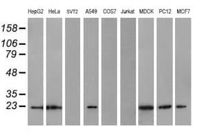 COMMD1 Antibody (clone OTI2D10)