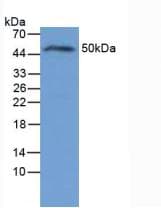 IL6R / IL6 Receptor Antibody (aa385-462)